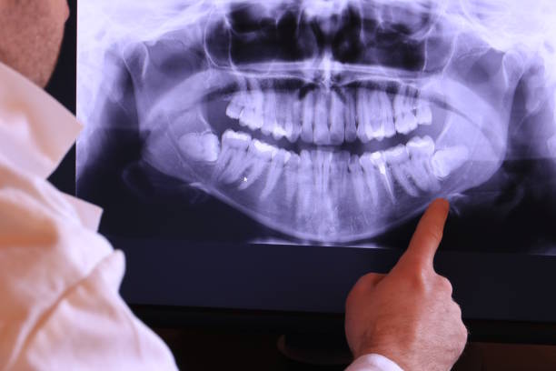 Best Mobile Emergency Dentist in Hurt, VA