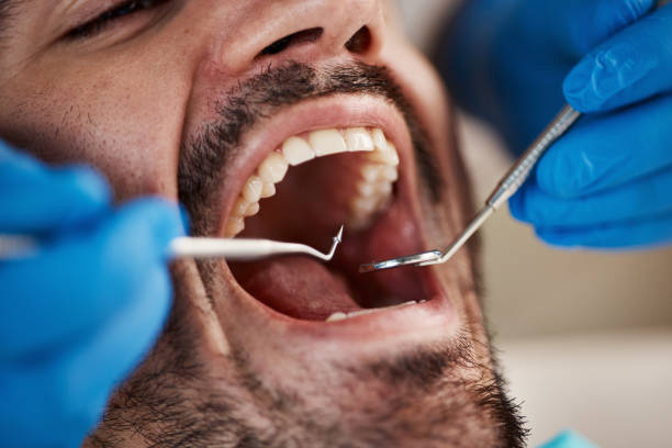 Best Emergency Root Canal Treatment in Hurt, VA